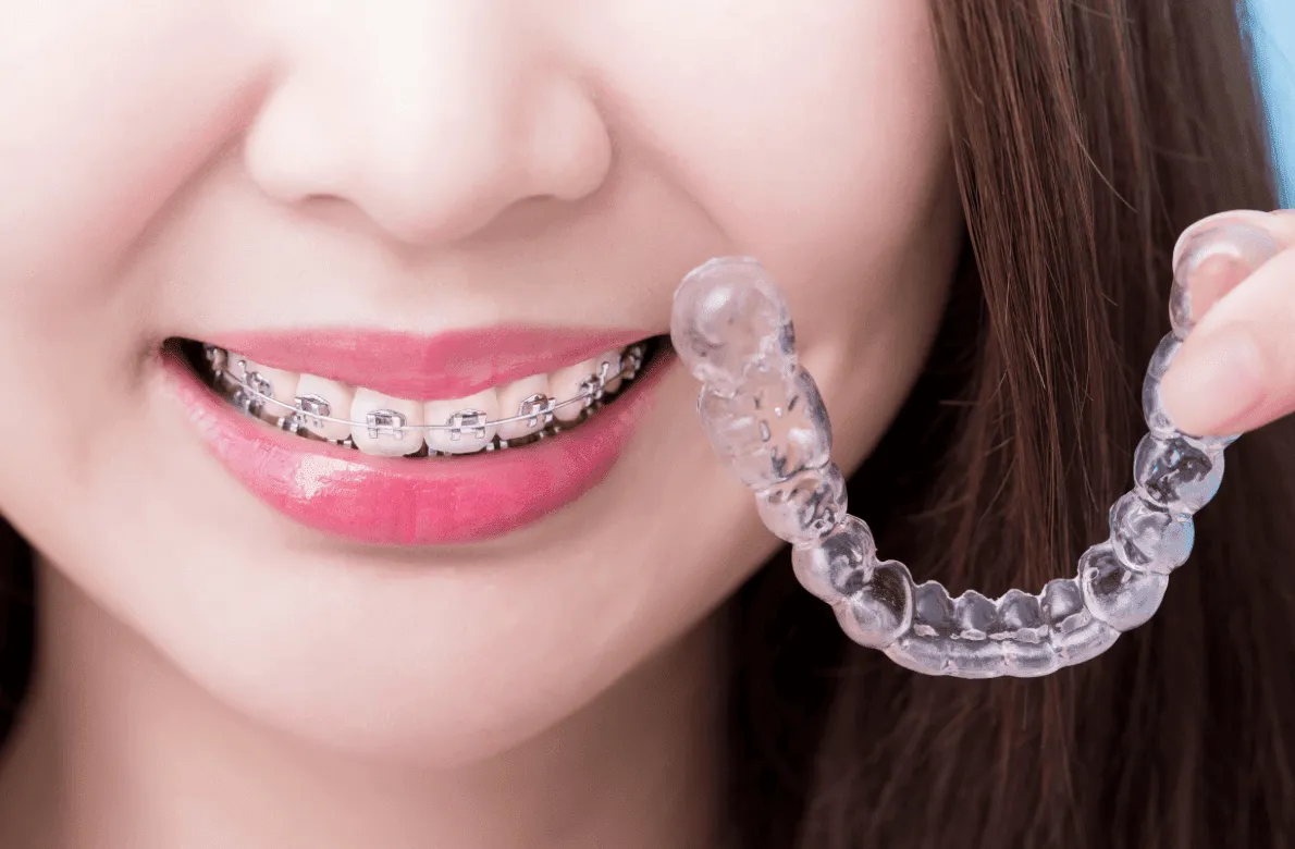 braces vs invisalign