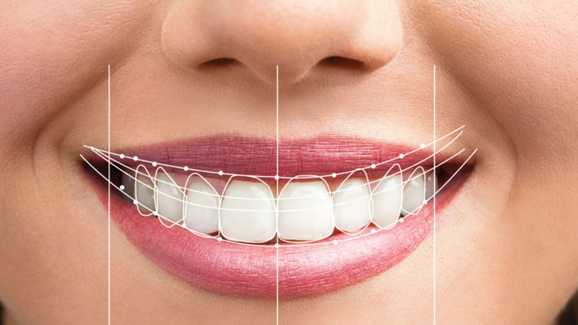 Digital Smile Design (DSD)