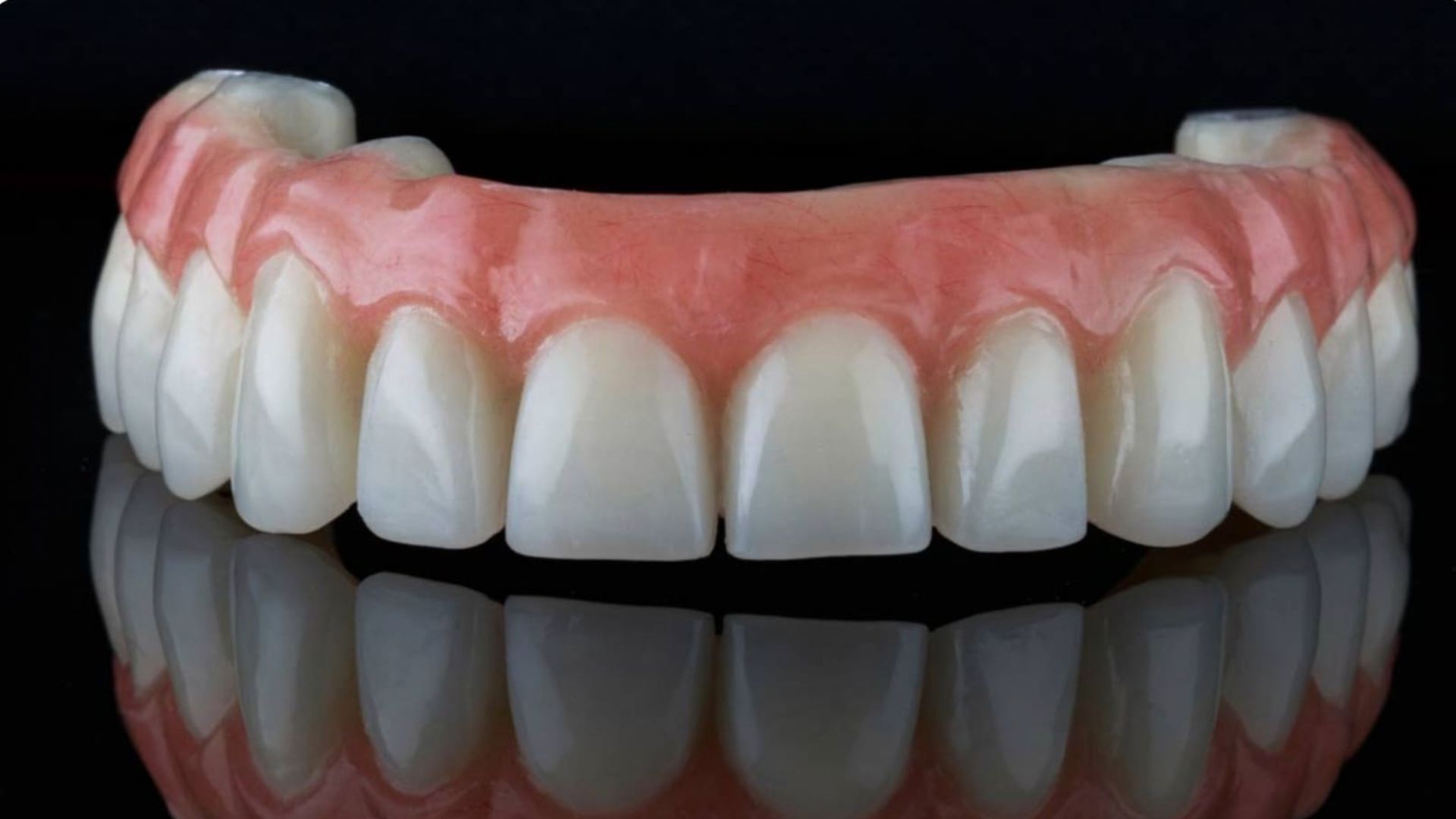 Complete Or Partial Dentures